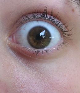 desensibilización sistemática